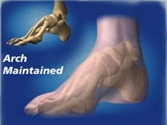 CMO Explanation | Pueblo Ankle and Foot Care, PLLC